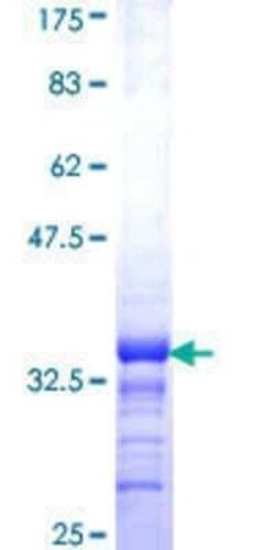 Novus Biologicals Recombinant Human DAZAP2 GST (N-Term) Protein 25 &mu;g | Buy Online | Novus Biologicals&trade; | Fisher Scientific