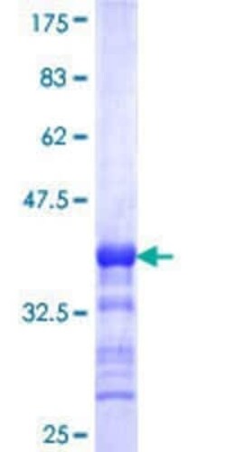 Novus Biologicals Recombinant Human IP6K1 GST (N-Term) Protein 25 &mu;g | Buy Online | Novus Biologicals&trade; | Fisher Scientific