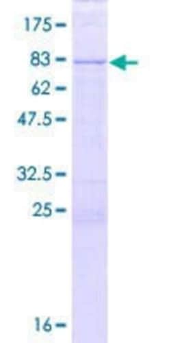 Novus Biologicals Recombinant Human Death Ligand Signal Enhancer GST (N-Term) Protein 2 &mu;g | Buy Online | Novus Biologicals&trade; | Fisher Scientific