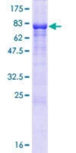 Novus Biologicals Recombinant Human EFCAB14 GST (N-Term) Protein 10 &mu;g | Buy Online | Novus Biologicals&trade; | Fisher Scientific