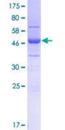 Novus Biologicals Recombinant Human SFI1 GST (N-Term) Protein 25 &mu;g | Buy Online | Novus Biologicals&trade; | Fisher Scientific