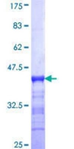 Novus Biologicals Recombinant Human GIT2 GST (N-Term) Protein 10 &mu;g | Buy Online | Novus Biologicals&trade; | Fisher Scientific