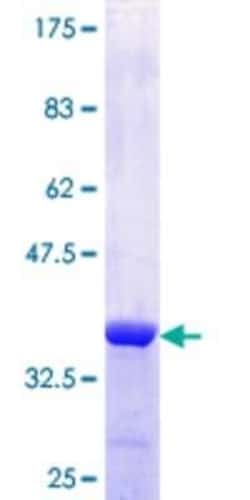 Novus Biologicals Recombinant Human NUPL1 GST (N-Term) Protein 25 &mu;g | Buy Online | Novus Biologicals&trade; | Fisher Scientific