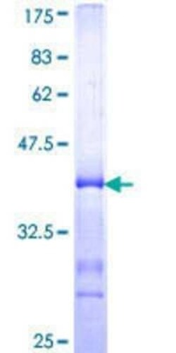 Novus Biologicals Recombinant Human TSC22D2 GST (N-Term) Protein 25 &mu;g | Buy Online | Novus Biologicals&trade; | Fisher Scientific