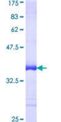 Novus Biologicals Recombinant Human Cullin-7 GST (N-Term) Protein 25 &mu;g | Buy Online | Novus Biologicals&trade; | Fisher Scientific