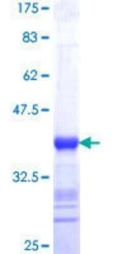 Novus Biologicals Recombinant Human SPATA2 GST (N-Term) Protein 25 &mu;g | Buy Online | Novus Biologicals&trade; | Fisher Scientific