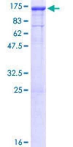 Novus Biologicals Recombinant Human DNAJC6 GST (N-Term) Protein 10 &mu;g | Buy Online | Novus Biologicals&trade; | Fisher Scientific