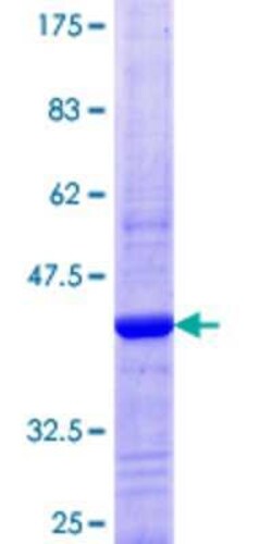 Novus Biologicals Recombinant Human DNAJC6 GST (N-Term) Protein 25 &mu;g | Buy Online | Novus Biologicals&trade; | Fisher Scientific