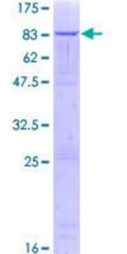 Novus Biologicals Recombinant Human ZNF623 GST (N-Term) Protein 25 &mu;g | Buy Online | Novus Biologicals&trade; | Fisher Scientific