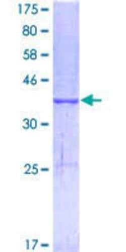 Novus Biologicals Recombinant Human MELK GST (N-Term) Protein 25 &mu;g | Buy Online | Novus Biologicals&trade; | Fisher Scientific