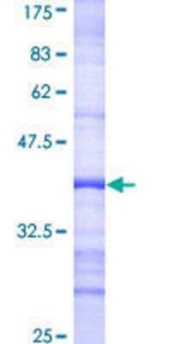 Novus Biologicals Recombinant Human ELMO1 GST (N-Term) Protein 10 &mu;g | Buy Online | Novus Biologicals&trade; | Fisher Scientific