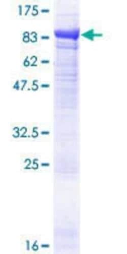 Novus Biologicals Recombinant Human EPM2AIP1 GST (N-Term) Protein 25 &mu;g | Buy Online | Novus Biologicals&trade; | Fisher Scientific