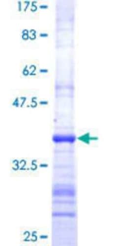 Novus Biologicals Recombinant Human EPM2AIP1 GST (N-Term) Protein 25 &mu;g | Buy Online | Novus Biologicals&trade; | Fisher Scientific