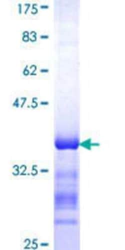 Novus Biologicals Recombinant Human FARP2 GST (N-Term) Protein 25 &mu;g | Buy Online | Novus Biologicals&trade; | Fisher Scientific