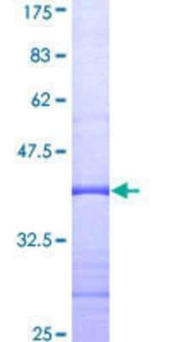 Novus Biologicals Recombinant Human MED24 GST (N-Term) Protein 25 &mu;g | Buy Online | Novus Biologicals&trade; | Fisher Scientific