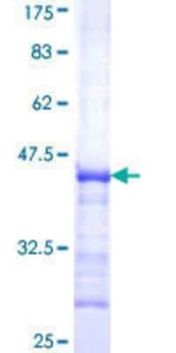Novus Biologicals Recombinant Human SETDB1 GST (N-Term) Protein 10 &mu;g | Buy Online | Novus Biologicals&trade; | Fisher Scientific