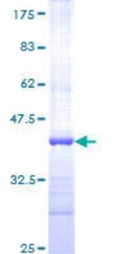 Novus Biologicals Recombinant Human AREL1 GST (N-Term) Protein 10 &mu;g | Buy Online | Novus Biologicals&trade; | Fisher Scientific