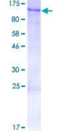 Novus Biologicals Recombinant Human FCHSD2 GST (N-Term) Protein 2 &mu;g | Buy Online | Novus Biologicals&trade; | Fisher Scientific