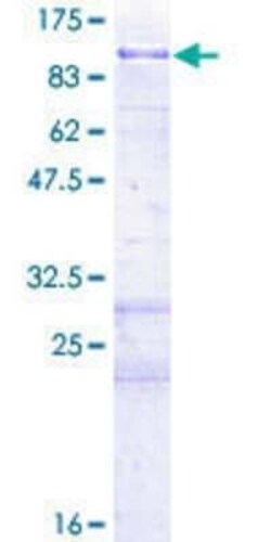 Novus Biologicals Recombinant Human ARK5/NUAK1 GST (N-Term) Protein 2 &mu;g | Buy Online | Novus Biologicals&trade; | Fisher Scientific