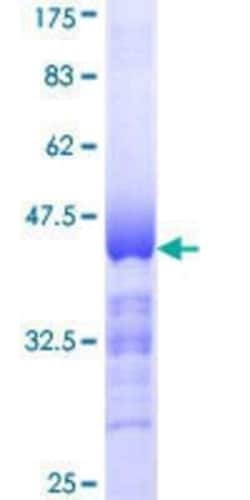 Novus Biologicals Recombinant Human ARK5/NUAK1 GST (N-Term) Protein 25 &mu;g | Buy Online | Novus Biologicals&trade; | Fisher Scientific