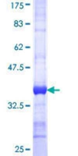 Novus Biologicals Recombinant Human AP180 GST (N-Term) Protein 25 &mu;g | Buy Online | Novus Biologicals&trade; | Fisher Scientific