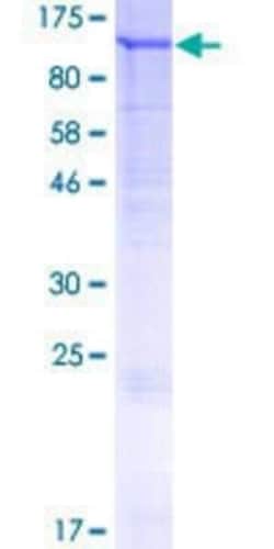 Novus Biologicals Recombinant Human FIG4 GST (N-Term) Protein 25 &mu;g | Buy Online | Novus Biologicals&trade; | Fisher Scientific