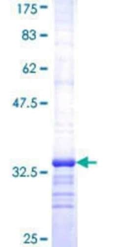 Novus Biologicals Recombinant Human SV2A GST (N-Term) Protein 10 &mu;g | Buy Online | Novus Biologicals&trade; | Fisher Scientific