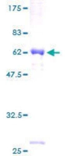 Novus Biologicals Recombinant Human SRGAP3 GST (N-Term) Protein 25 &mu;g | Buy Online | Novus Biologicals&trade; | Fisher Scientific