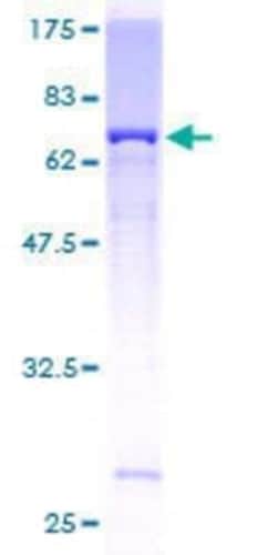 Novus Biologicals Recombinant Human AP5Z1 GST (N-Term) Protein 10 &mu;g | Buy Online | Novus Biologicals&trade; | Fisher Scientific