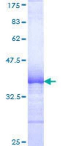 Novus Biologicals Recombinant Human CNAP1 GST (N-Term) Protein 25 &mu;g | Buy Online | Novus Biologicals&trade; | Fisher Scientific