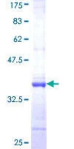 Novus Biologicals Recombinant Human USP52 GST (N-Term) Protein 10 &mu;g | Buy Online | Novus Biologicals&trade; | Fisher Scientific