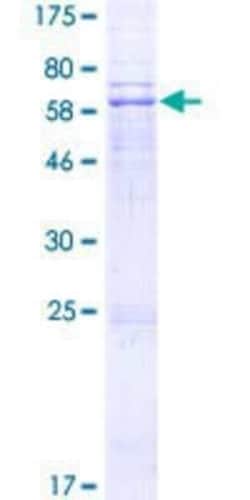 Novus Biologicals Recombinant Human LPGAT1 GST (N-Term) Protein 2 &mu;g | Buy Online | Novus Biologicals&trade; | Fisher Scientific