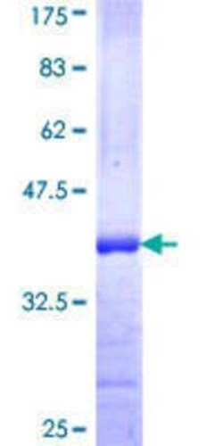 Novus Biologicals Recombinant Human Mitofusin 2 GST (N-Term) Protein 10 &mu;g | Buy Online | Novus Biologicals&trade; | Fisher Scientific