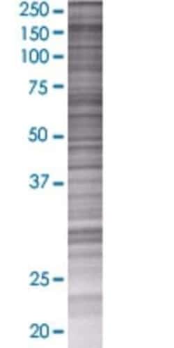 Novus Biologicals KIF14 293T Cell Transient Overexpression Lysate 0,1 mL | Buy Online | Novus Biologicals&trade; | Fisher Scientific