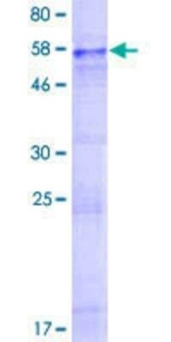 Novus Biologicals Recombinant Human P2Y14/GPR105 GST (N-Term) Protein 2 &mu;g | Buy Online | Novus Biologicals&trade; | Fisher Scientific
