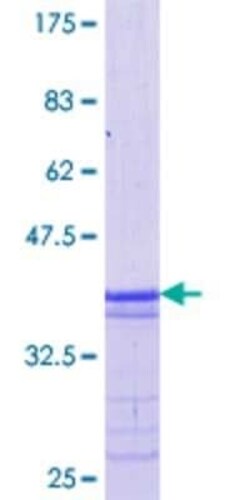 Novus Biologicals Recombinant Human MafB GST (N-Term) Protein 25 &mu;g | Buy Online | Novus Biologicals&trade; | Fisher Scientific