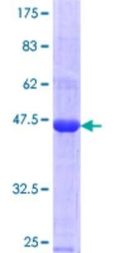 Novus Biologicals Recombinant Human MAGEC1 GST (N-Term) Protein 10 &mu;g | Buy Online | Novus Biologicals&trade; | Fisher Scientific