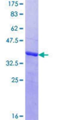 Novus Biologicals Recombinant Human MAGEC1 GST (N-Term) Protein 25 &mu;g | Buy Online | Novus Biologicals&trade; | Fisher Scientific