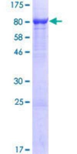 Novus Biologicals Recombinant Human WDR1 GST (N-Term) Protein 25 &mu;g | Buy Online | Novus Biologicals&trade; | Fisher Scientific