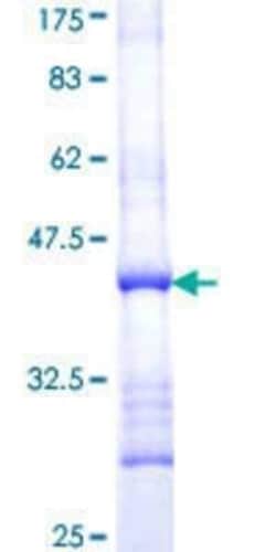 Novus Biologicals Recombinant Human AMMECR1 GST (N-Term) Protein 25 &mu;g | Buy Online | Novus Biologicals&trade; | Fisher Scientific