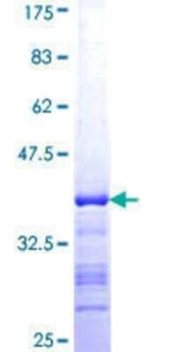 Novus Biologicals Recombinant Human GOLGA5 GST (N-Term) Protein 25 &mu;g | Buy Online | Novus Biologicals&trade; | Fisher Scientific