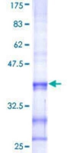 Novus Biologicals Recombinant Human HS3ST3A1 GST (N-Term) Protein 10 &mu;g | Buy Online | Novus Biologicals&trade; | Fisher Scientific
