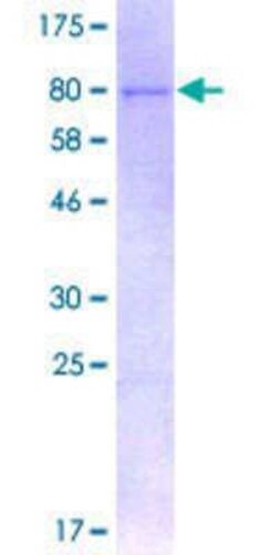 Novus Biologicals Recombinant Human USP3 GST (N-Term) Protein 2 &mu;g | Buy Online | Novus Biologicals&trade; | Fisher Scientific