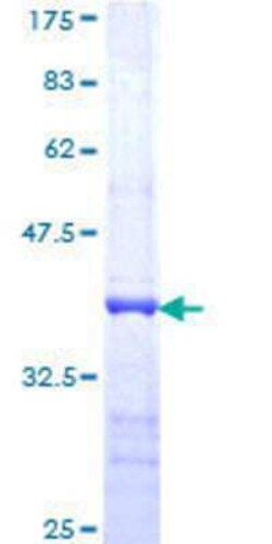 Novus Biologicals Recombinant Human USP3 GST (N-Term) Protein 10 &mu;g | Buy Online | Novus Biologicals&trade; | Fisher Scientific