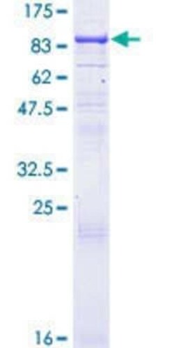 Novus Biologicals Recombinant Human REC8 GST (N-Term) Protein 25 &mu;g | Buy Online | Novus Biologicals&trade; | Fisher Scientific