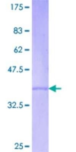 Novus Biologicals Recombinant Human REC8 GST (N-Term) Protein 2 &mu;g | Buy Online | Novus Biologicals&trade; | Fisher Scientific