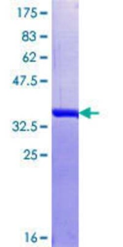 Novus Biologicals Recombinant Human HNRPDL GST (N-Term) Protein 10 &mu;g | Buy Online | Novus Biologicals&trade; | Fisher Scientific