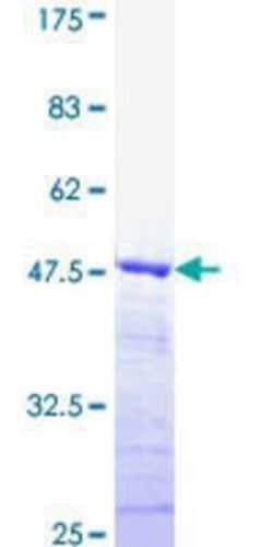 Novus Biologicals Recombinant Human DMTF1 GST (N-Term) Protein 25 &mu;g | Buy Online | Novus Biologicals&trade; | Fisher Scientific