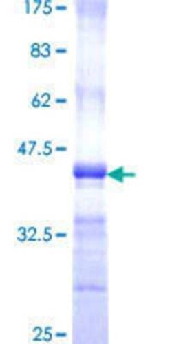 Novus Biologicals Recombinant Human PPP4R1 GST (N-Term) Protein 10 &mu;g | Buy Online | Novus Biologicals&trade; | Fisher Scientific