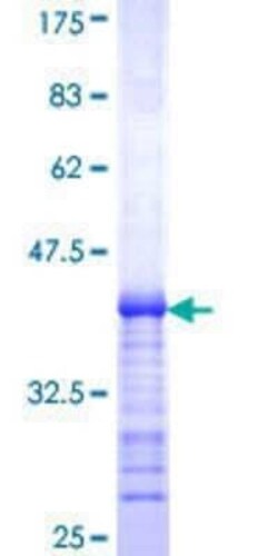Novus Biologicals Recombinant Human KCC3/SLC12A6 GST (N-Term) Protein 10 &mu;g | Buy Online | Novus Biologicals&trade; | Fisher Scientific